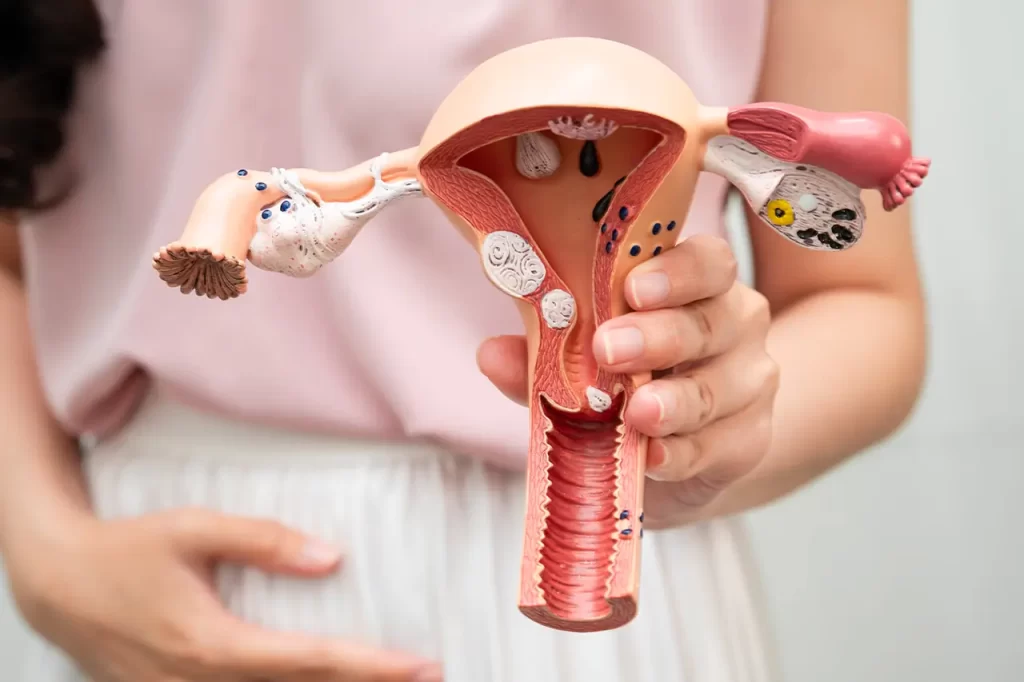 Cirugía cáncer útero Quito Dr Carlos Riofrio Cirujano Oncologo