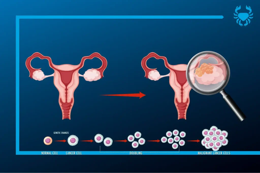 Cirugía cáncer ovario Quito Dr Carlos Riofrio Cirujano Oncólogo