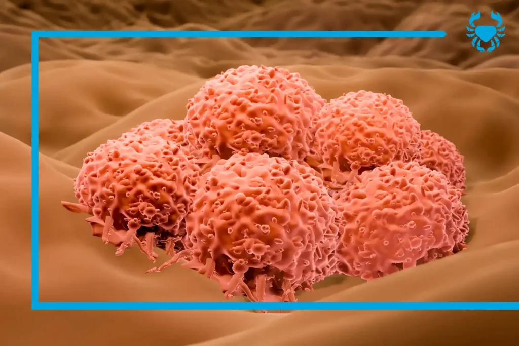 Cirugía cáncer piel Quito Dr Carlos Riofrio Cirujano Oncólogo